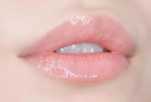 豐唇后多久能消腫?豐唇術注意事項