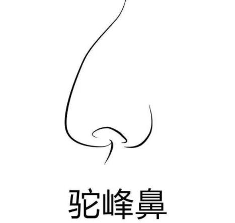 駝峰鼻矯正多少錢?駝峰鼻糾正方法有哪些?