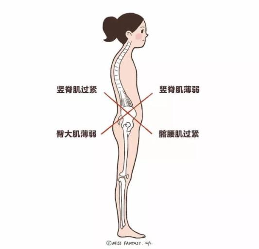 骨盆前傾怎么矯正 腹肌背肌臀部髂腰肌訓練調整走路姿勢