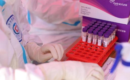 做核酸檢測前可以喝熱水嗎 核酸檢測前為什么不能喝熱水