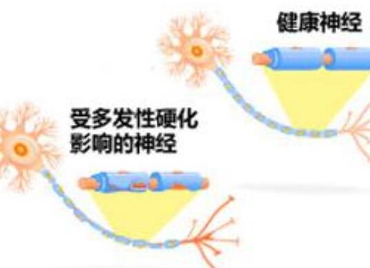 十大女性易得的病排行榜,乳腺癌發不了高、宮頸癌是惡性腫瘤