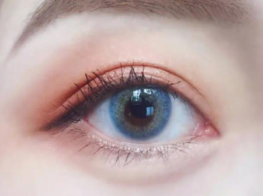 雙眼皮太寬太深去哪里修復(fù)好?雙眼皮疤痕凹陷能自然長平嗎 雙眼皮太寬太深去哪里修復(fù)好?雙眼皮疤痕凹陷能自然長平嗎