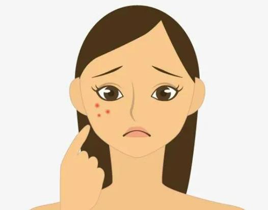 臉上全是痘印是什么原因?激素臉排出來的激素怎么看得出來 臉上全是痘印是什么原因?激素臉排出來的激素怎么看得出來