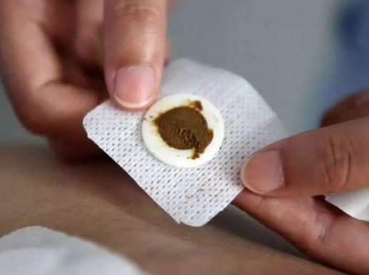 貼三伏貼不能吃什么水果?三伏貼初伏沒貼中伏還能貼嗎 貼三伏貼不能吃什么水果?三伏貼初伏沒貼中伏還能貼嗎