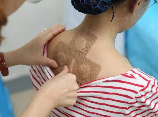 三伏貼是三伏天每天都貼嗎?三伏貼忌口是忌口一伏天嗎 三伏貼是三伏天每天都貼嗎?三伏貼忌口是忌口一伏天嗎