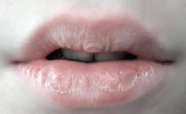 經(jīng)常涂潤唇膏對嘴唇好嗎 嘴唇干裂脫皮怎么處理 經(jīng)常涂潤唇膏對嘴唇好嗎 嘴唇干裂脫皮怎么處理