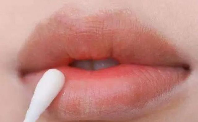 凡士林唇膜天天用會導致唇炎嗎?慢性唇炎怎么治 凡士林唇膜天天用會導致唇炎嗎?慢性唇炎怎么治