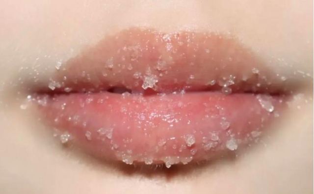凡士林唇膜天天用會導致唇炎嗎?慢性唇炎怎么治 凡士林唇膜天天用會導致唇炎嗎?慢性唇炎怎么治