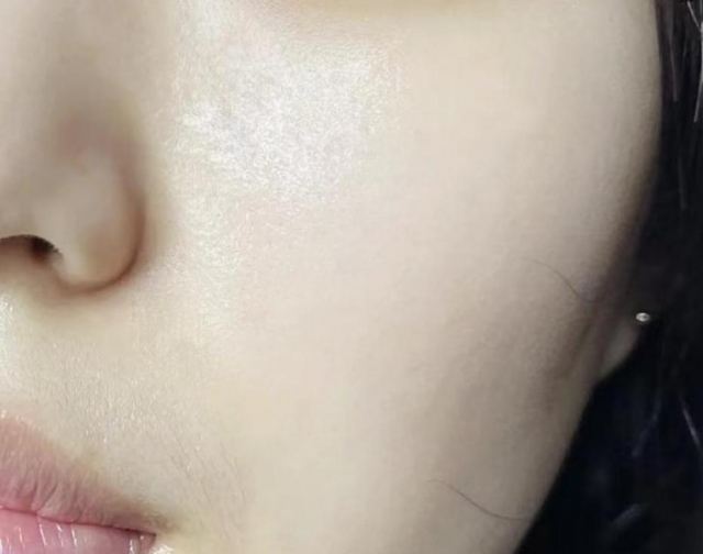 臉油頭發(fā)油是濕氣重嗎 臉出油和脾胃有關(guān)系嗎 臉油頭發(fā)油是濕氣重嗎 臉出油和脾胃有關(guān)系嗎