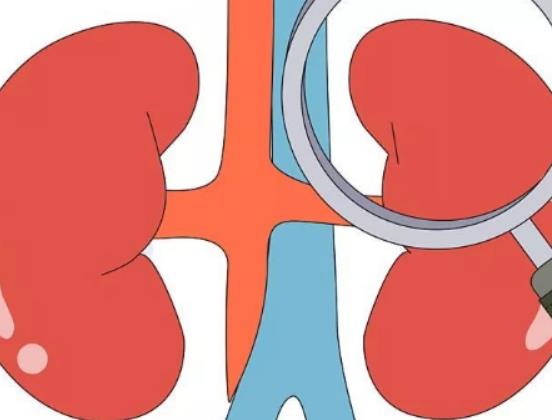 喝可樂會引起腎結石嗎?腎結石超聲波碎石疼嗎 喝可樂會引起腎結石嗎?腎結石超聲波碎石疼嗎