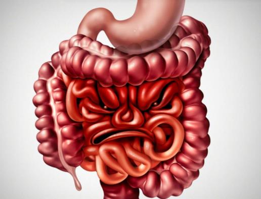 治結腸炎用哪些中藥?結腸炎如何檢查 治結腸炎用哪些中藥?結腸炎如何檢查